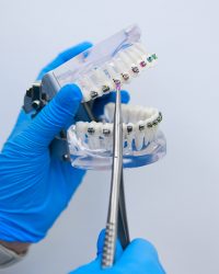 ortodoncja wieliczka