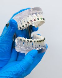 ortodoncja wieliczka